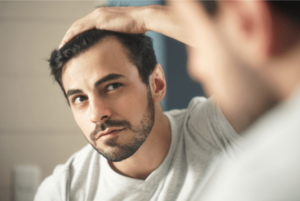 Hair loss treatments in Men