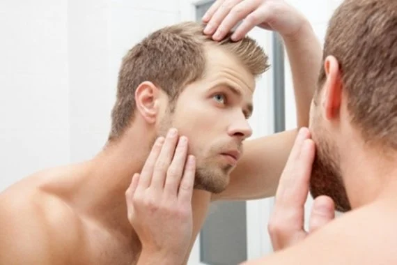 Topical Hair Loss