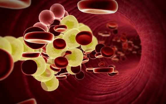 High Cholesterol Treatment Online